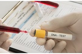 DNA paternity test services in Rwanda increased nearly four-fold in five years